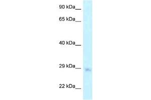 WB Suggested Anti-MTG1 Antibody Titration: 1.