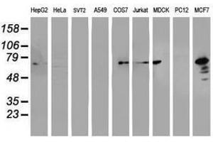 Image no. 3 for anti-Protein Disulfide Isomerase Family A, Member 4 (PDIA4) antibody (ABIN1500108) (PDIA4 抗体)