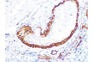 Immunohistochemistry of paraffin-embedded rat ovary using LDHB Rabbit mAb (ABIN7268170) at dilution of 1:100 (40x lens). (LDHB 抗体)
