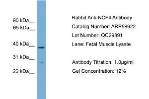 WB Suggested Anti-NCF4  Antibody Titration: 0. (NCF4 抗体  (C-Term))