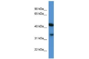 WB Suggested Anti-Centa1 Antibody Titration: 0. (ADAP1 抗体  (C-Term))