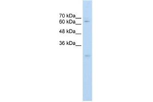 WB Suggested Anti-CES2 Antibody Titration:  0. (CES2 抗体  (C-Term))