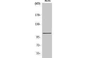 Western Blotting (WB) image for anti-ATP/GTP Binding Protein-Like 2 (AGBL2) (C-Term) antibody (ABIN3174226) (AGBL2 抗体  (C-Term))