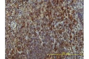 Image no. 1 for anti-Linker For Activation of T Cells (LAT) (AA 1-234) antibody (ABIN599213) (LAT 抗体  (AA 1-234))