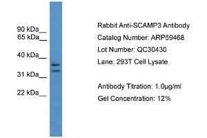 WB Suggested Anti-SCAMP3  Antibody Titration: 0. (SCAMP3 抗体  (N-Term))