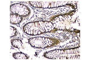 IHC analysis of CA2 using anti-CA2 antibody (ABIN6719533). (CA2 抗体  (AA 2-260))