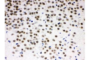 ZBTB7A was detected in paraffin-embedded sections of rat brain tissues using rabbit anti- ZBTB7A Antigen Affinity purified polyclonal antibody at 1 μg/mL. (ZBTB7A 抗体  (N-Term))