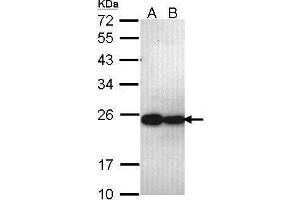WB Image Sample (30 ug of whole cell lysate) A: A431 , B: H1299 12% SDS PAGE antibody diluted at 1:1000 (PSMB5 抗体  (C-Term))