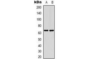 Western blot analysis of TIGD1 expression in HEK293T (A), Hela (B) whole cell lysates. (TIGD1 抗体)