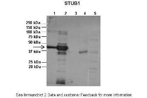 Lanes:   1:1ug insoluble STUB1 protein, 2:1ug soluble STUB1 protein, 3:1ug EPM2A protein, 4:1ug insoluble PPP1R3C protein, 5:1ug soluble PPP1R3C protein  Primary Antibody Dilution:   1:2500  Secondary Antibody:   Anti-rabbit-AP  Secondary Antibody Dilution:   1:20,000  Gene Name:   STUB1  Submitted by:   Pedro Castanheira, Biocant (STUB1 抗体  (N-Term))