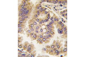 Immunohistochemistry (IHC) image for anti-Gap Junction Protein, alpha 5, 40kDa (GJA5) (AA 102-134), (N-Term) antibody (ABIN5536705)