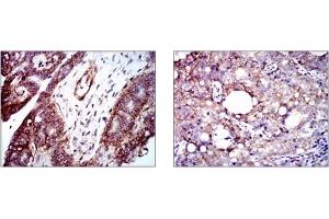 Immunohistochemistry (IHC) image for anti-Integrin beta 1 (ITGB1) antibody (ABIN1106231) (ITGB1 抗体)