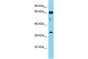 Western Blotting (WB) image for anti-Guanine Nucleotide Binding Protein (G Protein), beta Polypeptide 2-Like 1 (GNB2L1) (C-Term) antibody (ABIN2788764)