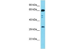Host: Rabbit Target Name: Gnb2l1 Sample Type: Mouse Stomach lysates Antibody Dilution: 1.
