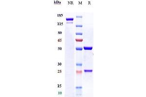 Anti-CALCRL / CGRPR Reference Antibody (erenumab) on SDS-PAGE under reducing (R) condition. (Recombinant CALCRL (Erenumab Biosimilar) 抗体)