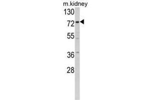 Western blot analysis of Villin-1 Antibody (N-term) in mouse kidney tissue lysates (35ug/lane). (Villin 1 抗体  (N-Term))