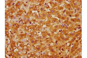Immunohistochemistry (IHC) image for anti-Casein Kinase 1, gamma 1 (CSNK1G1) (AA 1-125), (Isoform gamma 1) antibody (ABIN7146870)