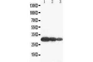 Anti-Aquaporin 6 antibody, Western blotting Lane 1: U87 Cell Lysate Lane 2: COLO320 Cell Lysate Lane 3: MCF-7 Cell Lysate (AQP6 抗体  (C-Term))