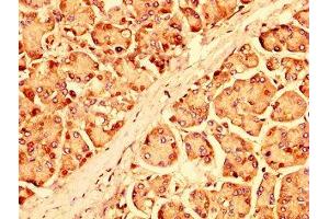 IHC image of ABIN7151293 diluted at 1:500 and staining in paraffin-embedded human pancreatic tissue performed on a Leica BondTM system. (UBR1 抗体  (AA 722-862))