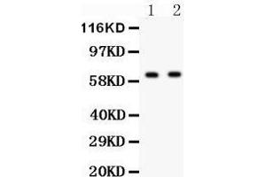 Anti- HEXB antibody, Western blotting All lanes: Anti HEXB  at 0. (HEXB 抗体  (AA 381-556))
