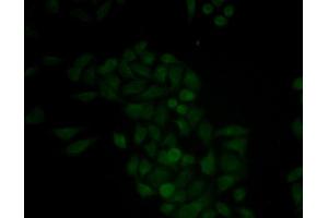 Immunofluorescence analysis of MCF-7 cell using CTSE antibody. (Cathepsin E 抗体)