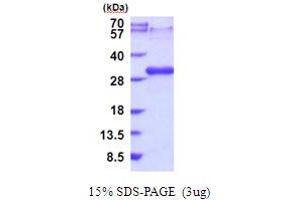 LTBR Protein (AA 28-227) (His tag)