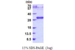 SDS-PAGE (SDS) image for Lymphotoxin beta Receptor (TNFR Superfamily, Member 3) (LTBR) (AA 28-227) protein (His tag) (ABIN5853989) (LTBR Protein (AA 28-227) (His tag))