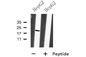 Western blot analysis of MRPS28 using HepG2 whole cell lysates (MRPS28 抗体  (C-Term))