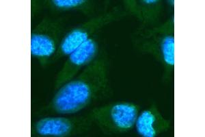 IF analysis of FGF10 using anti-FGF10 antibody (ABIN7601536). (FGF10 抗体  (AA 38-208))