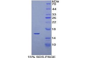 SDS-PAGE (SDS) image for Klotho beta (KLB) ELISA Kit (ABIN6720595)