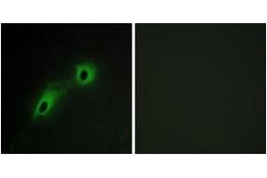 Immunofluorescence analysis of HeLa cells, using CAMK5 Antibody. (CAMKV 抗体  (AA 211-260))