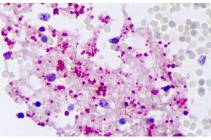 Anti-PPBP antibody IHC staining of human intravascular platelets. (CXCL7 抗体)