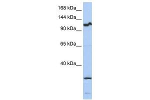 OSMR antibody used at 1 ug/ml to detect target protein.