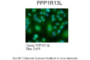 Immunohistochemistry (IHC) image for anti-Protein Phosphatase 1, Regulatory Subunit 13 Like (PPP1R13L) (Middle Region) antibody (ABIN2777612)