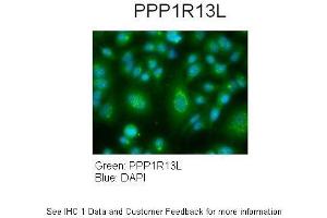Sample Type :  Human lung adenocarcinoma cell line A549  Primary Antibody Dilution :  1:100  Secondary Antibody :  Goat anti-rabbit AlexaFluor 488  Secondary Antibody Dilution :  1:400  Color/Signal Descriptions :  PPP1R13L: Green DAPI:Blue  Gene Name :  PPP1R13L   Submitted by :  Dr. (PPP1R13L 抗体  (Middle Region))