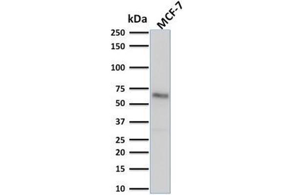 Estrogen Receptor alpha 抗体