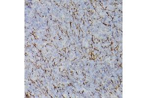 Immunohistochemistry (IHC) image for anti-Platelet Derived Growth Factor Receptor alpha (PDGFRA) (AA 1-210) antibody (ABIN3022921)