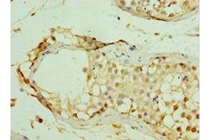 Immunohistochemistry of paraffin-embedded human testis tissue using ABIN7159289 at dilution of 1:100 (MAGEC2 抗体  (AA 1-150))