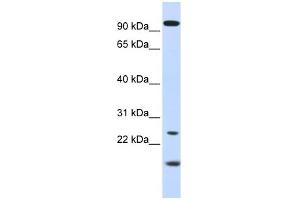 WB Suggested Anti-GUCA1A Antibody Titration: 0. (GCAP1 抗体  (N-Term))