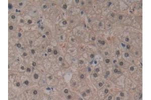 Detection of SDH in Human Liver Tissue using Polyclonal Antibody to Sorbitol Dehydrogenase (SDH) (SORD 抗体  (AA 98-355))