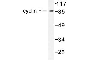 Image no. 1 for anti-Cyclin F (CCNF) antibody (ABIN265381) (Cyclin F 抗体)