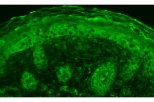 SPC108 Anti Calnexin CT, mouse backskin. (Calnexin 抗体  (C-Term))