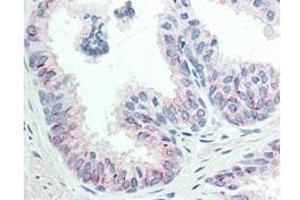 Immunohistochemistry (IHC) image for anti-V-Akt Murine Thymoma Viral Oncogene Homolog 1 (AKT1) (pSer473) antibody (ABIN349614)