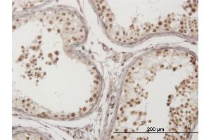 Immunoperoxidase of monoclonal antibody to FLJ20097 on formalin-fixed paraffin-embedded human testis. (Syndetin/VPS50 抗体  (AA 862-964))