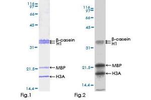 Kinase Activity Assay (KAA) image for serine/threonine Kinase 33 (STK33) (AA 1-514) protein (GST tag) (ABIN1321694) (STK33 Protein (AA 1-514) (GST tag))
