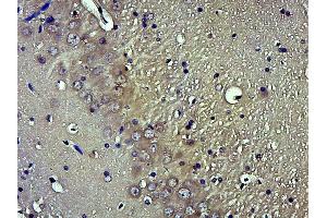 Immunohistochemistry (Paraffin-embedded Sections) (IHC (p)) image for anti-Neurotrophic Tyrosine Kinase, Receptor, Type 1 (NTRK1) (pTyr817) antibody (ABIN703330)