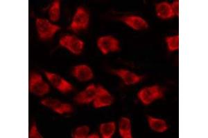 Immunofluorescence (fixed cells) (IF/ICC) image for anti-Olfactory Receptor, Family 5, Subfamily M, Member 3 (OR5M3) antibody (ABIN6263891)