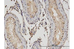Immunoperoxidase of monoclonal antibody to C1orf89 on formalin-fixed paraffin-embedded human testis.