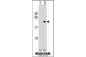 Western blot analysis of PLA2G12A using rabbit polyclonal PLA2G12A Antibody using 293 cell lysates (2 ug/lane) either nontransfected (Lane 1) or transiently transfected (Lane 2) with the PLA2G12A gene. (PLA2G12A 抗体  (AA 55-83))
