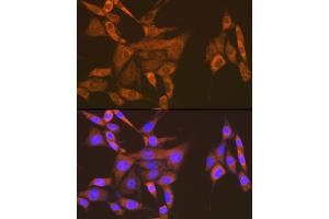 Immunofluorescence analysis of NIH-3T3 cells using USP9X Rabbit mAb (ABIN7271169) at dilution of 1:100 (40x lens). (USP9X 抗体)